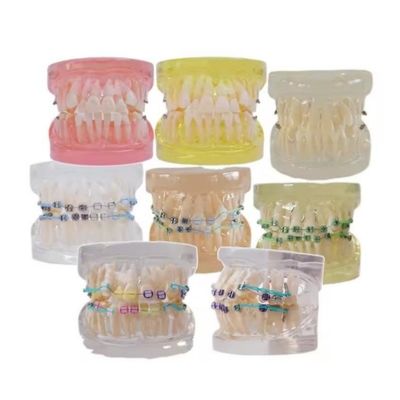 Çok Renkli İnsan Diş Modeli Diş Ortodontik Diş Modeli Braketli Çalışma İçin