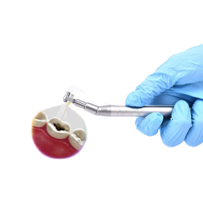 Kök Kanal Tedavisi için Görsel Dijital Diş Mikro Kamera Ağız İçi Endoskop